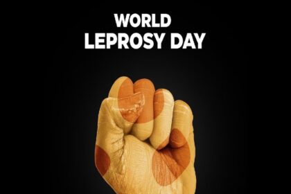 2024 01 140426122b79e529d0b6e7fde7177ab6 3x2 2024 01 140426122b79e529d0b6e7fde7177ab6 3x2 2024 01 140426122b79e529d0b6e7fde7177ab6 3x2