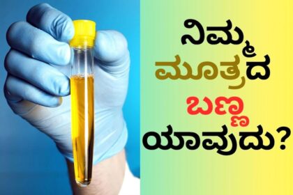 URINE 01 16961677953x2 URINE 01 16961677953x2 URINE 01 16961677953x2