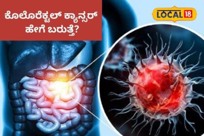 colo ph 2024 02 54049975f0428841da632a7c109c2977 3x2 colo ph 2024 02 54049975f0428841da632a7c109c2977 3x2 colo ph 2024 02 54049975f0428841da632a7c109c2977 3x2