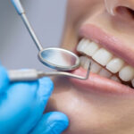 Dental Treatment
